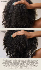 scalp solutions exfoliating scalp treatment