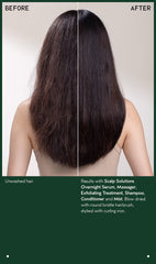 scalp solutions stimulating scalp massager